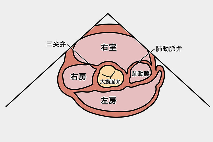 心臓弁膜症のイメージ画像2