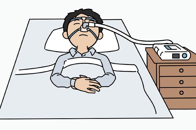 睡眠時無呼吸症候群のCpapイメージ画像