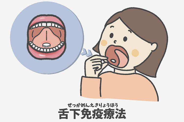 舌下免疫療法のイメージ画像